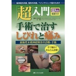 「超」入門手術で治すしびれと痛み―絞扼性末梢神経障害の診断・手術/Web動画付き 脳神経外科医、整形外科医、ペインクリニック医のための [単行本]