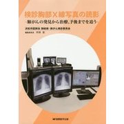 検診胸部X線写真の読影―肺がんの発見から治療、予後までを追う [単行本]