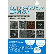 OCTアンギオグラフィコアアトラス－ケースで学ぶ読影のポイント [単行本]