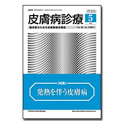 皮膚病診療 2017年 05月号 [雑誌]