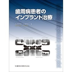 歯周病患者のインプラント治療 [単行本]
