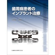 歯周病患者のインプラント治療 [単行本]