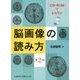 CD-ROMでレッスン 脳画像の読み方 第2版 [単行本]