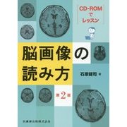 CD-ROMでレッスン 脳画像の読み方 第2版 [単行本]