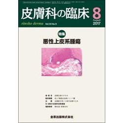皮膚科の臨床 2017年 08月号 [雑誌]