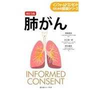 肺がん 改訂5版 (インフォームドコンセントのための図説シリーズ) [単行本]