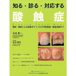 ヨドバシ.com - 知る・診る・対応する 酸蝕症 [単行本] 通販【全品無料