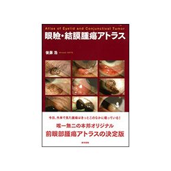 眼瞼・結膜腫瘍アトラス [単行本]