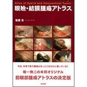 眼瞼・結膜腫瘍アトラス [単行本]