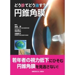 どう診てどう治す？円錐角膜 [単行本]