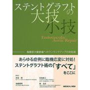 ステントグラフトの大技・小技－胸腹部大動脈瘤へのワンランクアップの対処術 [単行本]