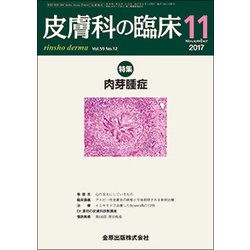 皮膚科の臨床 2017年 11月号 [雑誌]