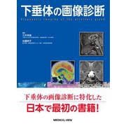 下垂体の画像診断 [単行本]