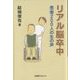 リアル脳卒中―患者200人の生の声 [単行本]