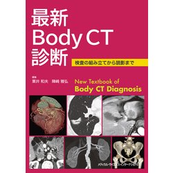 最新Body CT診断―検査の組み立てから読影まで [単行本]