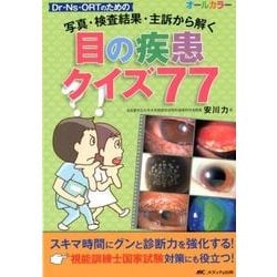 目の疾患クイズ77－写真・検査結果・主訴から解く Dr・Ns・ORTのための [単行本]