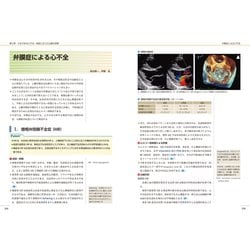 ヨドバシ.com - 心不全―識る・診る・治す(循環器内科専門医