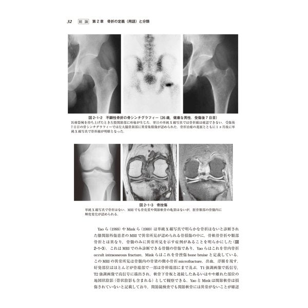 骨折・脱臼 改訂4版 [単行本] ccpamazonas.org