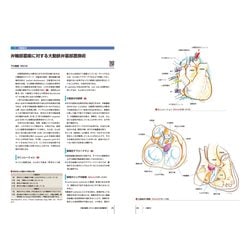 ヨドバシ.com - 弁膜症の手術(心臓血管外科手術エクセレンス〈2