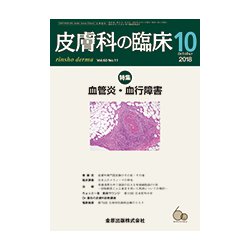 皮膚科の臨床 2018年 10月号 [雑誌]
