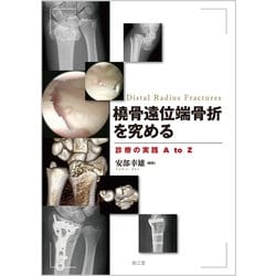 橈骨遠位端骨折を究める-診療の実践 A to Z [単行本]
