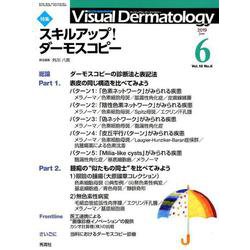 Visual D. 2019年6月号 Vol.18 No.6（Visual.Dermatology） [全集叢書]