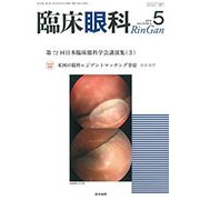 臨床眼科 2019年 05月号 [雑誌]