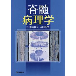 脊髄病理学 橋詰良夫 吉田眞理 ヨドバシ.com - 脊髄病理学 [単行本] 通販【全品無料配達】