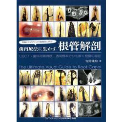 写真とエビデンスで歯種別に学ぶ! 歯内療法に生かす根管解剖 写真とエビデンスで歯種別に学ぶ! 歯内療法に生かす根管解剖