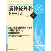 脳神経外科ジャーナル 2019年 07月号 [雑誌]