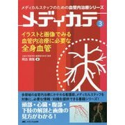 イラストと画像でみる血管内治療に必要な全身血管（メディカルスタッフのための血管内治療シリーズ メディカテ3） [単行本]