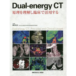 Dual-energy CT―原理を理解し臨床で活用する [単行本]