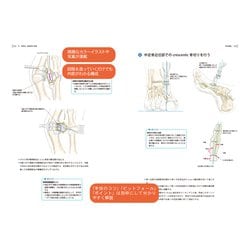 ヨドバシ.com - 下腿・足の手術 DVD付 (整形外科手術イラストレイ 