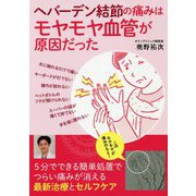 ヘバーデン結節の痛みはモヤモヤ血管が原因だった [単行本]