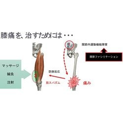 ヨドバシ.com - 痛みの9割がたちまち消える10秒関節リセット [単行本