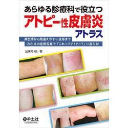 あらゆる診療科で役立つアトピー性皮膚炎アトラス [単行本]