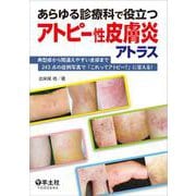 あらゆる診療科で役立つアトピー性皮膚炎アトラス [単行本]