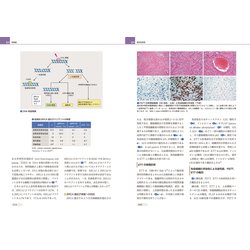 ヨドバシ.com - 悪性腫瘍(Science and Practice 産科婦人科臨床