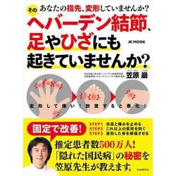 そのヘバーデン結節、足やひざにも起きていませんか？-あなたの指先、変形していませんか？ [ムックその他]