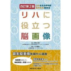 ヨドバシ.com - コツさえわかればあなたも読める リハに役立つ脳画像