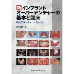 ヨドバシ.com - 新 インプラントオーバーデンチャーの基本と臨床