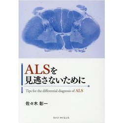 ALSを見逃さないために [単行本]