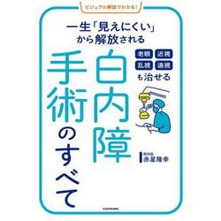 ビジュアル解説でわかる!老眼、近視、乱視、遠視も治せる白内障手術のすべて―一生「見えにくい」から解放される [単行本]
