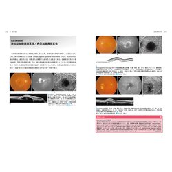 ヨドバシ.com - 黄斑部（眼科診療ビジュアルラーニング〈6〉） [全集