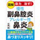 図解 自力で治す!慢性副鼻腔炎アレルギー性鼻炎 [単行本]