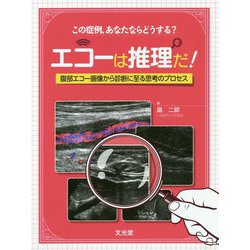 【高額売筋】 ヨドバシ.com エコーは推理だ!―腹部エコー画像から診断に至る - 放射線医学・核医学