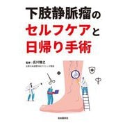 下肢静脈瘤のセルフケアと日帰り手術 [単行本]