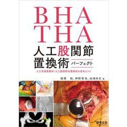 BHA・THA 人工股関節置換術パーフェクト [単行本]