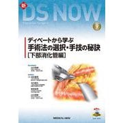 ディベートから学ぶ手術法の選択・手技の秘訣［下部消化管編］(新DS NOW<9>) [全集叢書]