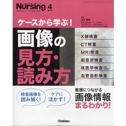 ケースから学ぶ!画像の見方、読み方 増刊月刊 nursing (ナーシング) 2021年 04月号 [雑誌]